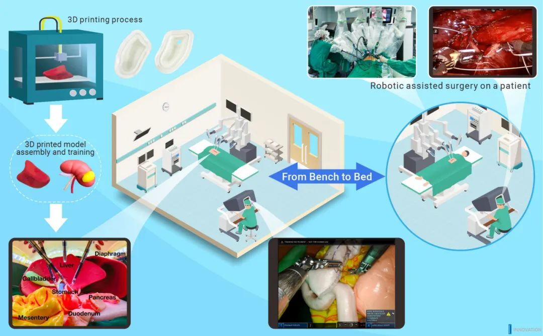  रोबोट-सहायता प्राप्त सर्जरी और 3डी मुद्रित मॉडल